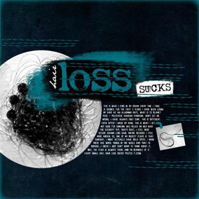 Hair Loss Sucks