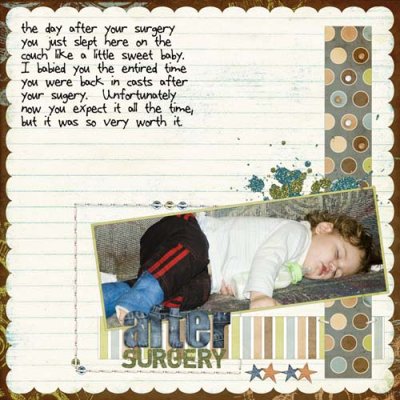 After Surgery