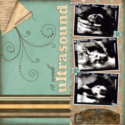 Ultrasound