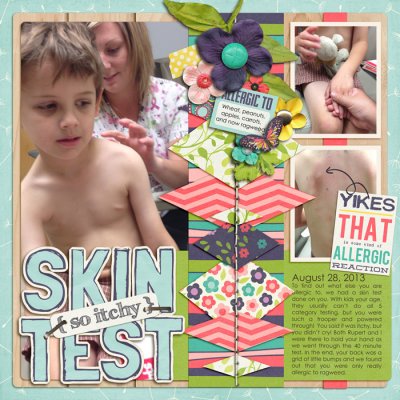 skin test