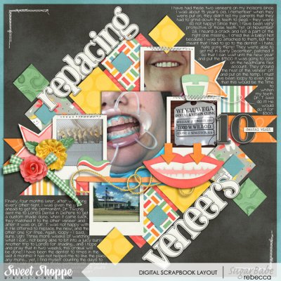 replacing veneers