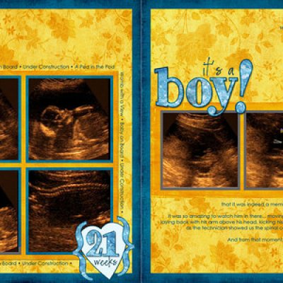 20 weeks Ultrasound - It's a BOY!