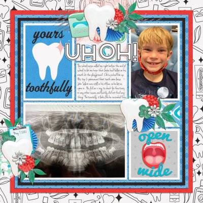 Gabe700mouth-accident-Tinci_CM13_1-Recovered