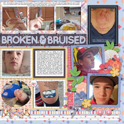 Broken Nose - Right