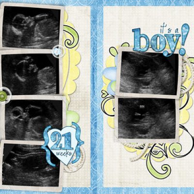 {rescrap}  21 weeks - big ultrasound