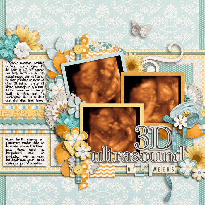 3D ultrasound