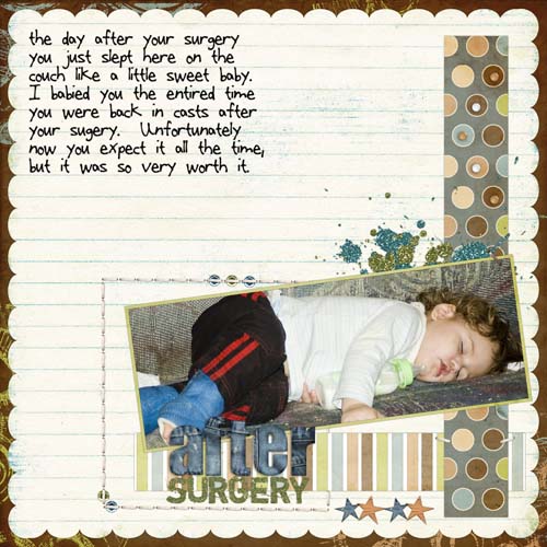 After Surgery