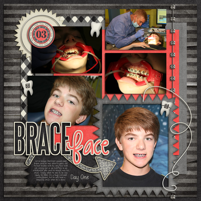 Brace Face