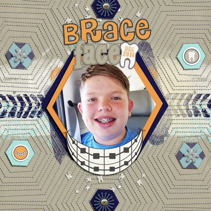 Brace Face