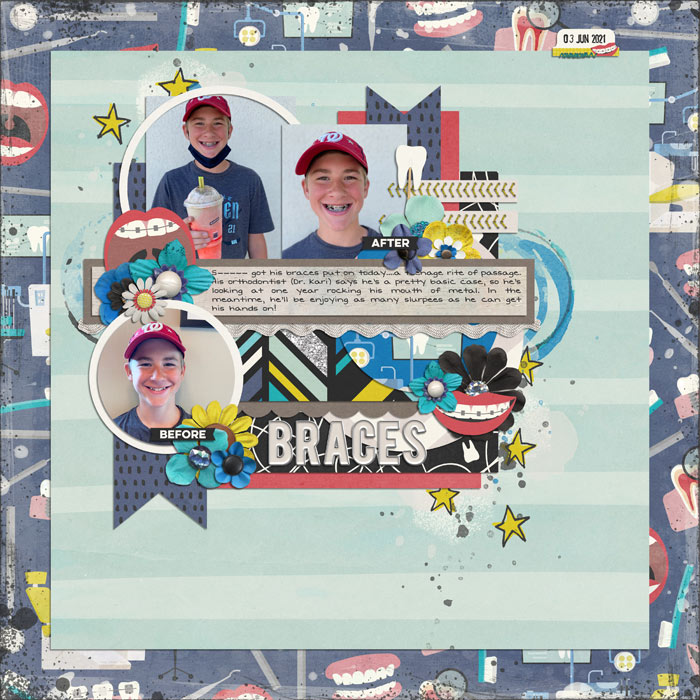 Braces