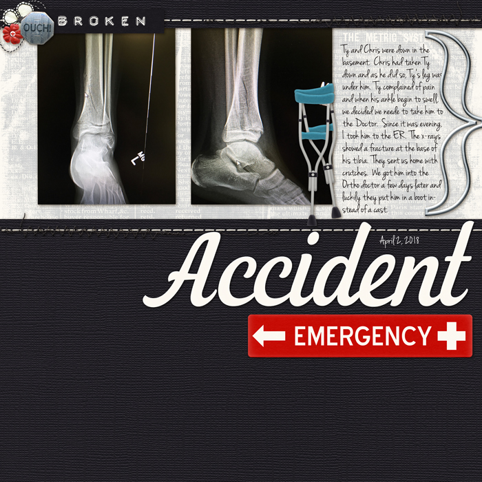 Broken Leg