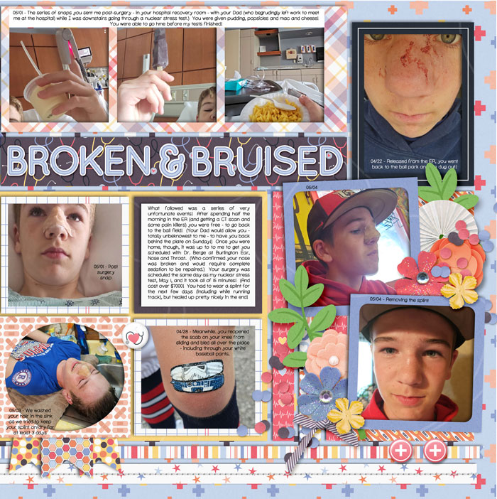Broken Nose - Right