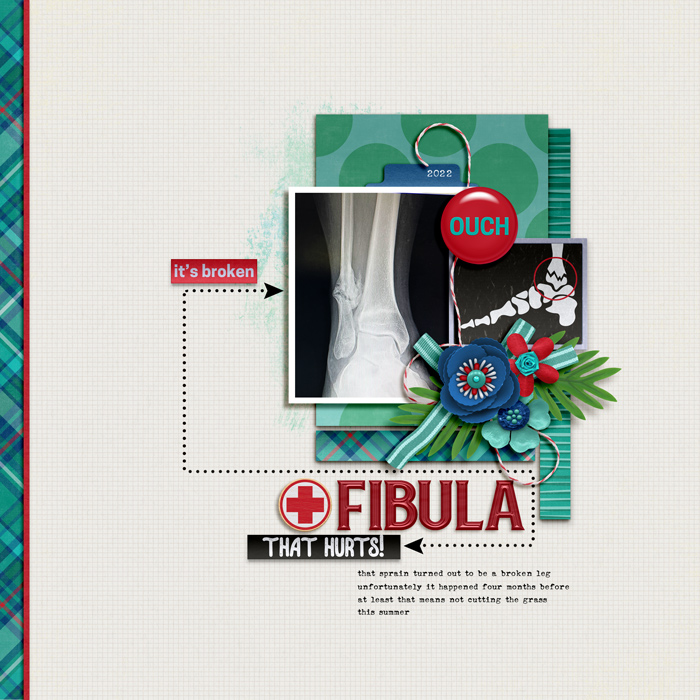 fibula