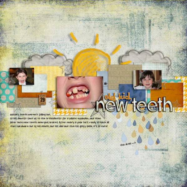 Mason's New Teeth