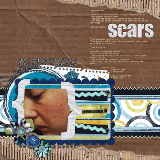 Scars
