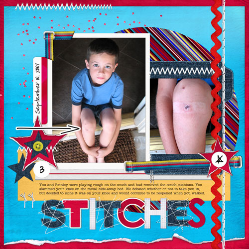 Stitches