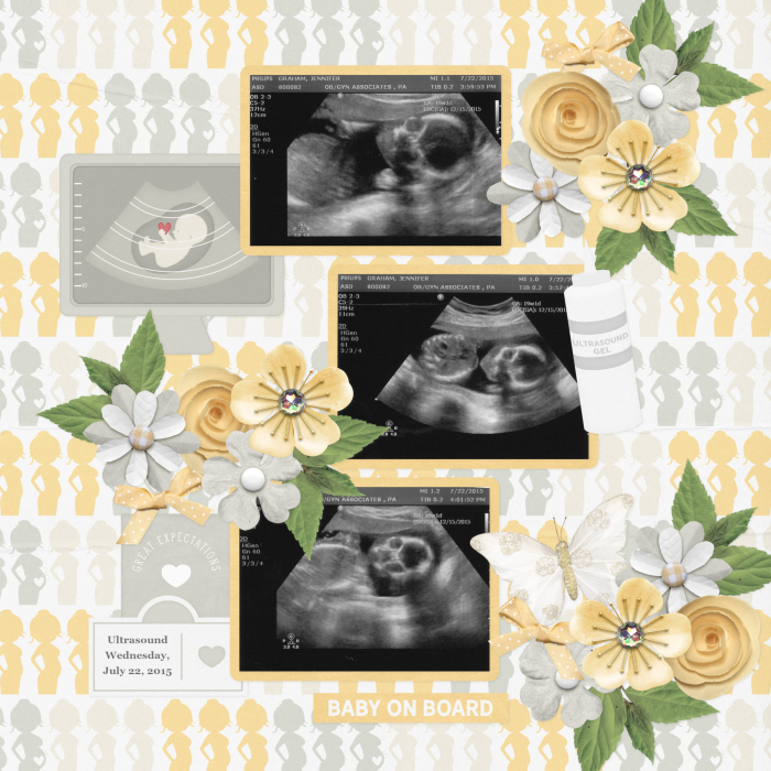 Ultrasound