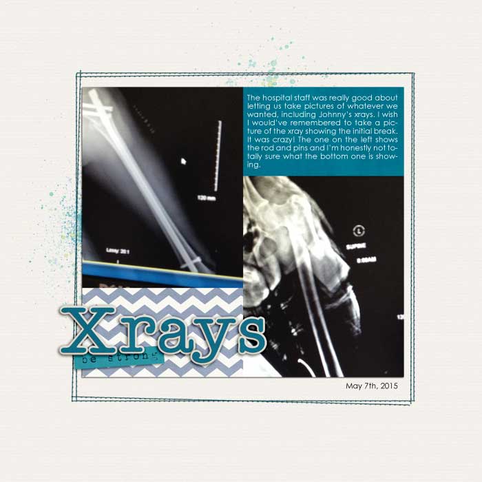 Xrays