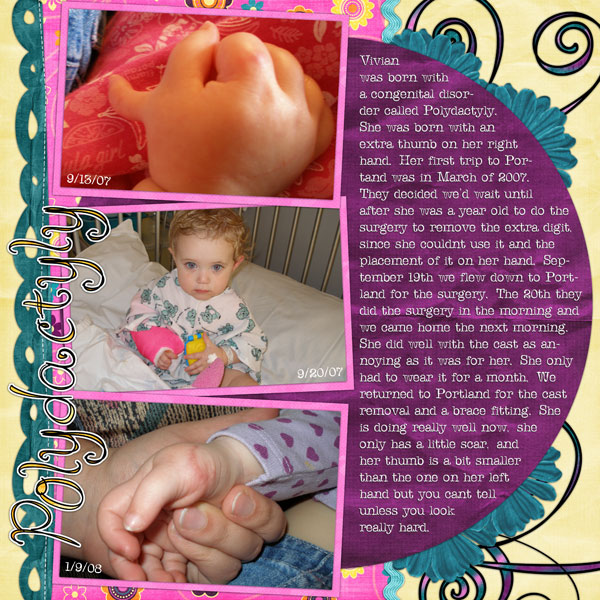 20080109vjpolydactylysm