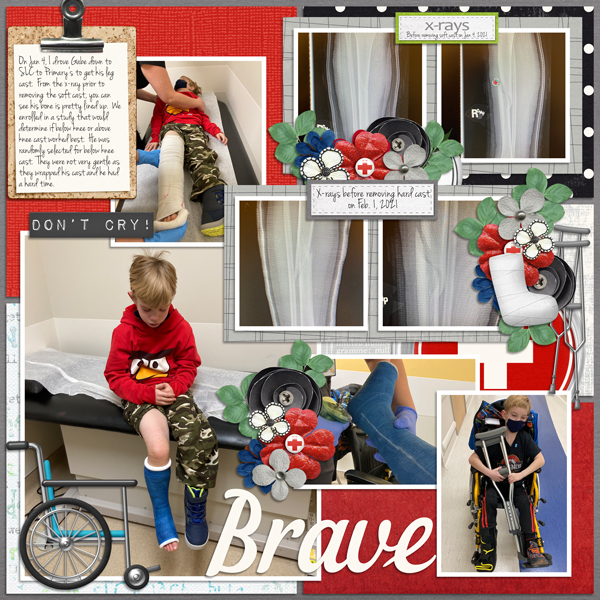 Gabe600-broken-leg-Tinci_DecM3_3