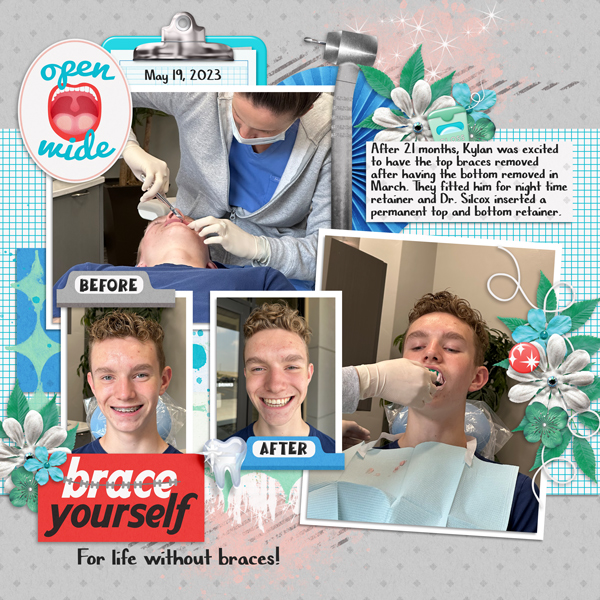 Kylan600-braces-removed-Tinci_MM20_3