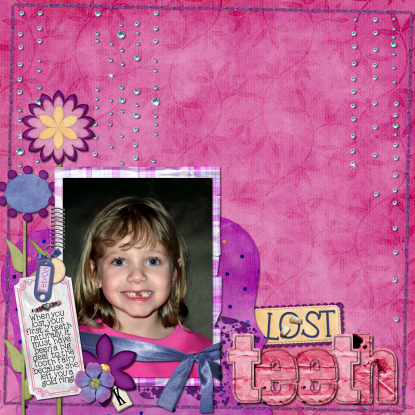 LostTeethLOSample