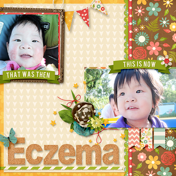 Overcoming-Eczema-Right