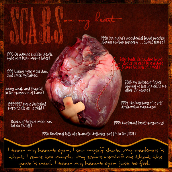 Scars