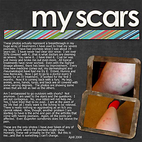 SugarFreeChallenge_41_MyScars_SMALL