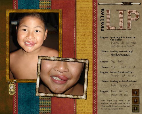Swollen_Lip_copy