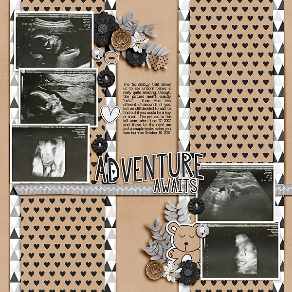 Ultrasounds