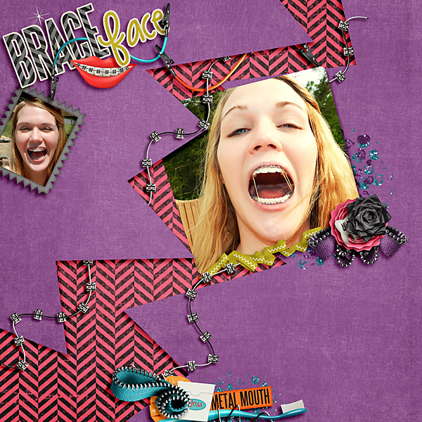 braceface