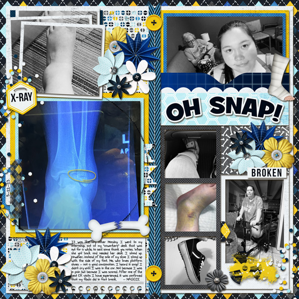 maggies-broken-ankle