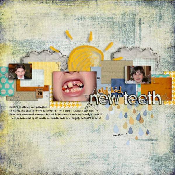 Mason's New Teeth