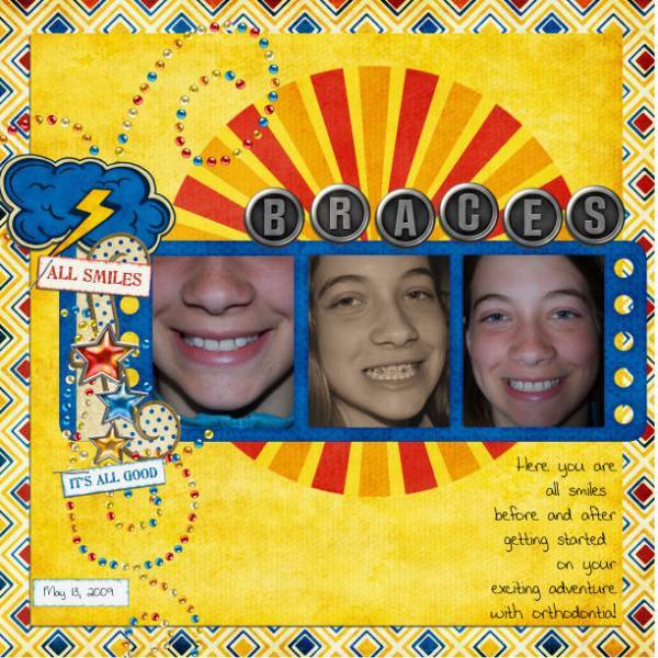 Braces