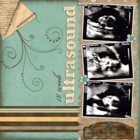 18-week-US-Caleb.jpg