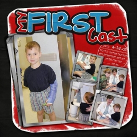 Josh_getting_Cast_4-18-02.jpg