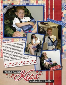 Josh_s_broken_arm_4-16-02.jpg