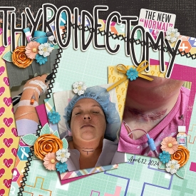 MC_thyroidectomy_CT7.jpg