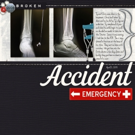 Ty_s-broken-leg.jpg