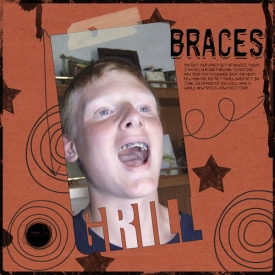 Upperbracesweb.jpg