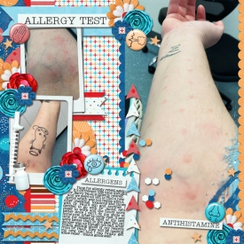 allergy-testing.jpg