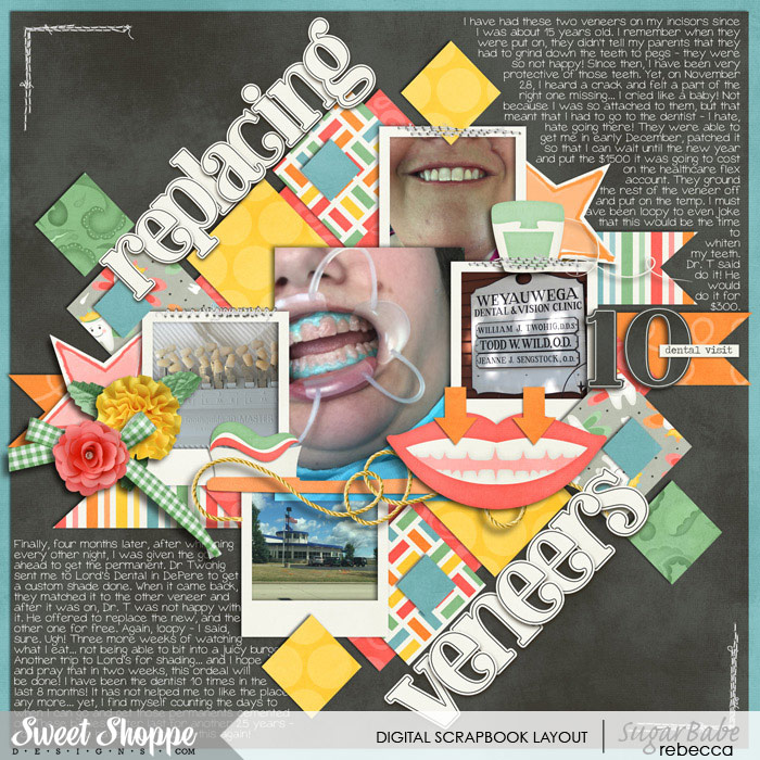 2015_8_12-replacing-veneers