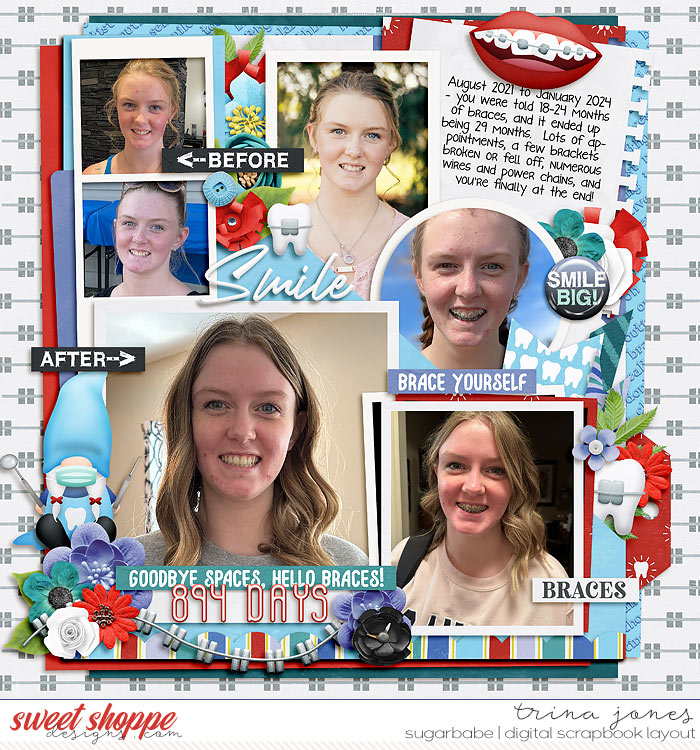 2024-01-Braces-offSB