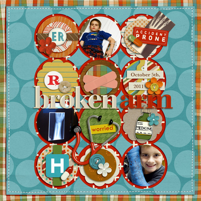 brokenarm1