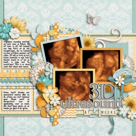 13-3D-ultrasound-web.jpg
