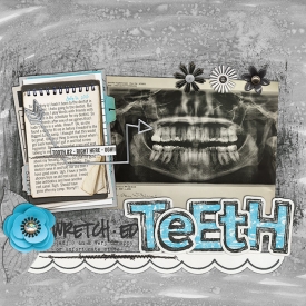 114_2015_wretchedteeth700w.jpg