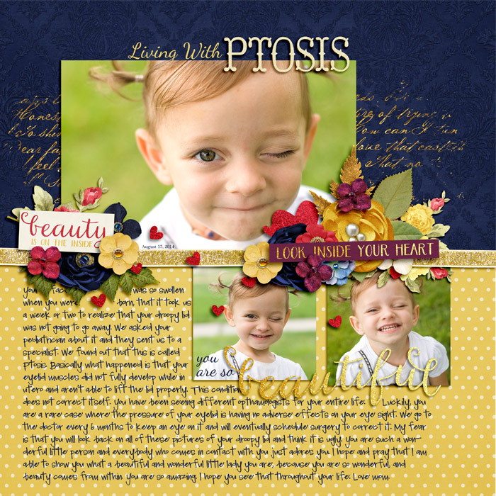 ptosis