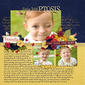 ptosis.jpg