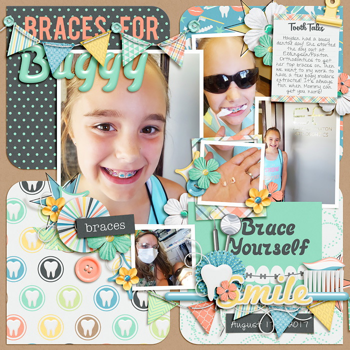 Braces_for_Buggy_sdd